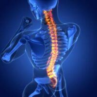 SpinalCordInjury SpinalCordInjury